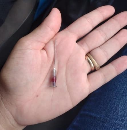 A agulha foi deixada injetada no 'bumbum' da criança de 6 anos, após aplicação intramuscular de medicação no pronto-socorro. ( Reprodução/Internet)