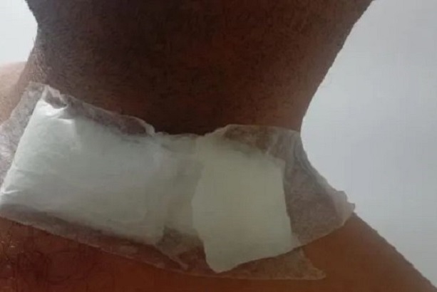 Motociclista tem pescoço cortado por linha com cerol e sobrevive na região Reprodução