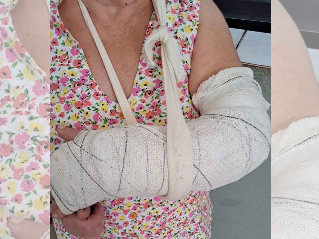 Suspeito de roubar galinhas e agredir casal de idosos é preso pela Polícia Civil idosa vitima de roubo