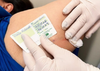 implante contraceptivo