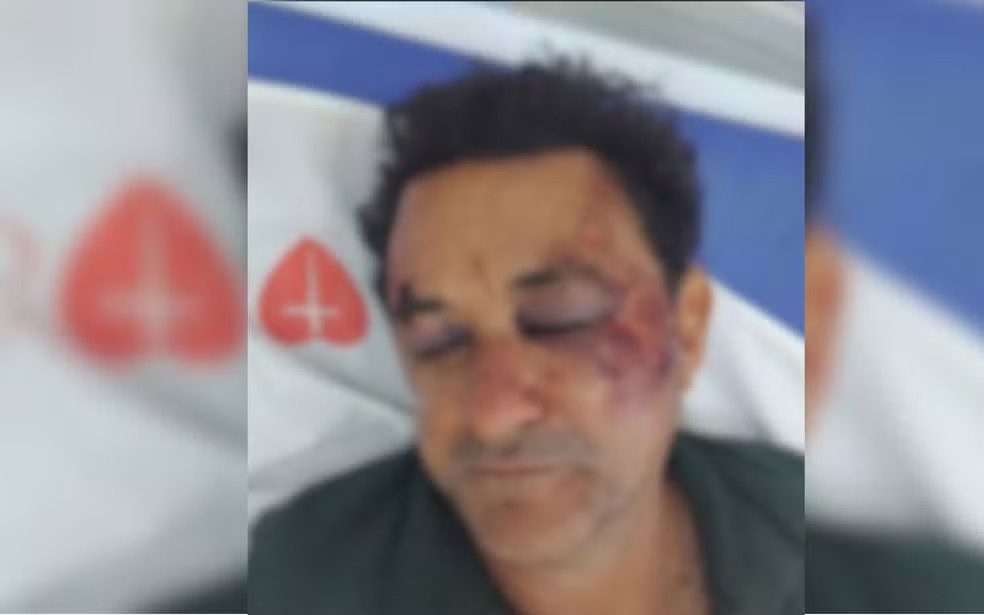 Garçom de 60 anos é agredido por grupo de jovens em Valparaíso O garçom Helzio Ramos Borges, de 60 anos, foi agredido em Valparaíso. (Foto: Arquivo pessoal)