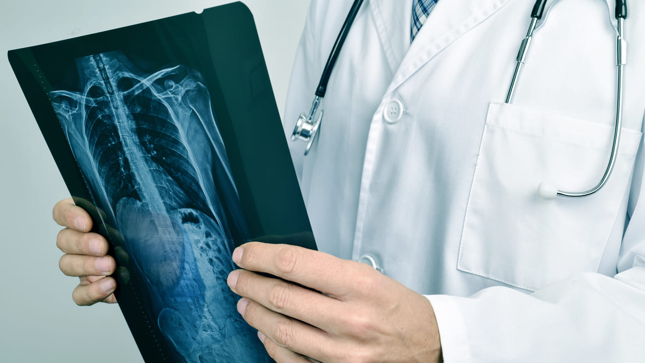Osteoporose atinge homens e mulheres de maneira diferente; veja cuidados Foto: nito103/Depositphotos