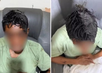 Um homem de 28 anos com deficiência intelectual grave precisou ter o cabelo raspado após voltar para casa com o corpo e a cabeça cobertos por óleo diesel queimado, no sábado (24), em Nova Granada, no interior de São Paulo. O produto ficou impregnado nos cabelos e na pele, dificultando a higienização. O jovem foi levado à Santa Casa do município, recebeu atendimento médico e teve alta na manhã de domingo (25).O caso ocorreu depois que o morador saiu de casa para ir a um pequeno mercado próximo à residência onde vive com os avós maternos. A família não sabe explicar como ele foi coberto pela substância nem em que circunstâncias o episódio aconteceu.**Avó relata desespero ao encontrar o neto**Em entrevista ao g1, a avó materna do jovem, Laudiceia Lisboa da Silva, de 73 anos, contou que ficou desesperada ao ver o estado do neto quando ele voltou para casa.Segundo ela, a quantidade de óleo dificultou até mesmo a tentativa de dar banho no rapaz. As roupas, as meias e os sapatos precisaram ser descartados devido à contaminação pelo produto.“Teve que tirar, tava muito grudado o óleo na cabeça dele. Só dava para ver os dentes e o branco do olho. A roupa, meia, sapato, tive que jogar tudo fora. Fui dar banho nele e não conseguia. Não sei por que aconteceu essa maldade com ele”, relatou a idosa.Diante da dificuldade para remover o óleo dos cabelos e do couro cabeludo, foi necessário raspar a cabeça do jovem.**Jovem precisa de acompanhamento médico**De acordo com a avó, o neto apresenta limitações motoras e dificuldades de fala desde os dez meses de idade, quando teve febre alta e sofreu duas convulsões. Desde então, ele necessita de acompanhamento neurológico e faz uso de medicamentos.Após o episódio, o jovem foi levado à Santa Casa de Nova Granada, onde recebeu atendimento para a higienização da pele e a retirada do produto químico. Ele teve alta médica na manhã de domingo.**Polícia apura as circunstâncias do caso**A Polícia Militar foi acionada e encontrou o jovem no pronto atendimento do município, acompanhado pelo avô. Segundo as informações divulgadas, os policiais não identificaram sinais aparentes de agressão física, como hematomas ou escoriações.Até a última atualização das informações, a família não havia conseguido esclarecer o que aconteceu durante o período em que o rapaz esteve fora de casa. Também não havia suspeitos identificados.Procurada pela TV TEM, a Polícia Civil informou que aguardava o registro formal do boletim de ocorrência pelos familiares para dar início às diligências.As circunstâncias do episódio ainda precisam ser esclarecidas. Não há confirmação sobre como o óleo diesel atingiu o corpo do jovem nem se houve uma ação intencional. A investigação deverá buscar informações que permitam determinar o que aconteceu.